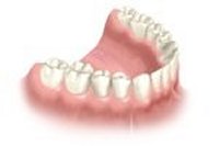 Replacing one or more teeth by implantology. Dentist and implantologist The Hague